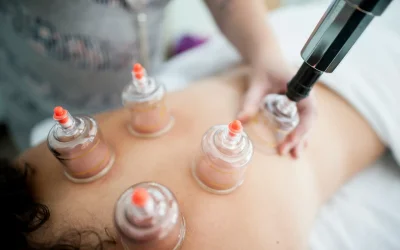 Cupping Massage